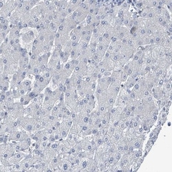 DGK-zeta Antibody, Novus Biologicals:Antibodies:Primary Antibodies